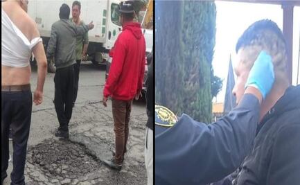 Riña en La Colmena termina con desprendimiento de oreja