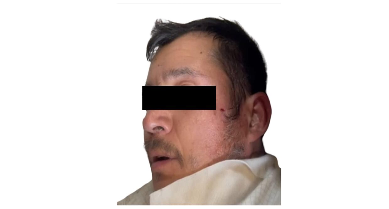 Muere el presunto asesino del periodista Cayetano Jesús Guerrero en Teoloyucan Foto Especial