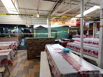 Nueva cirugía para bebé quemada en Amecameca