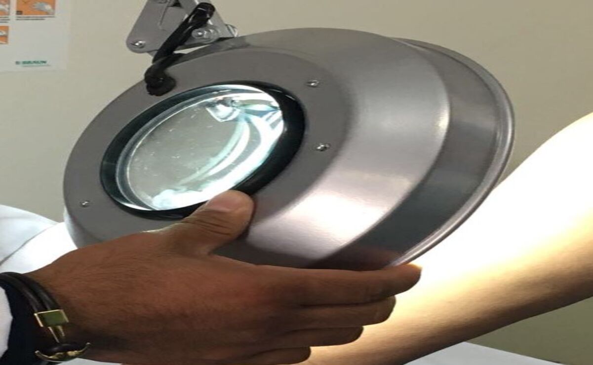 Los principales factores de riesgo para desarrollar esta enfermedad incluyen la exposición solar acumulada / Foto: Especial
