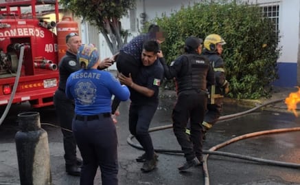 Incendio en casa deja un hombre quemado, una menor intoxicada y 4 perros rescatados en Neza