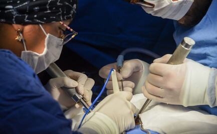 Alarma por riesgo renal: Edomex registra incremento en solicitudes para trasplantes de riñón