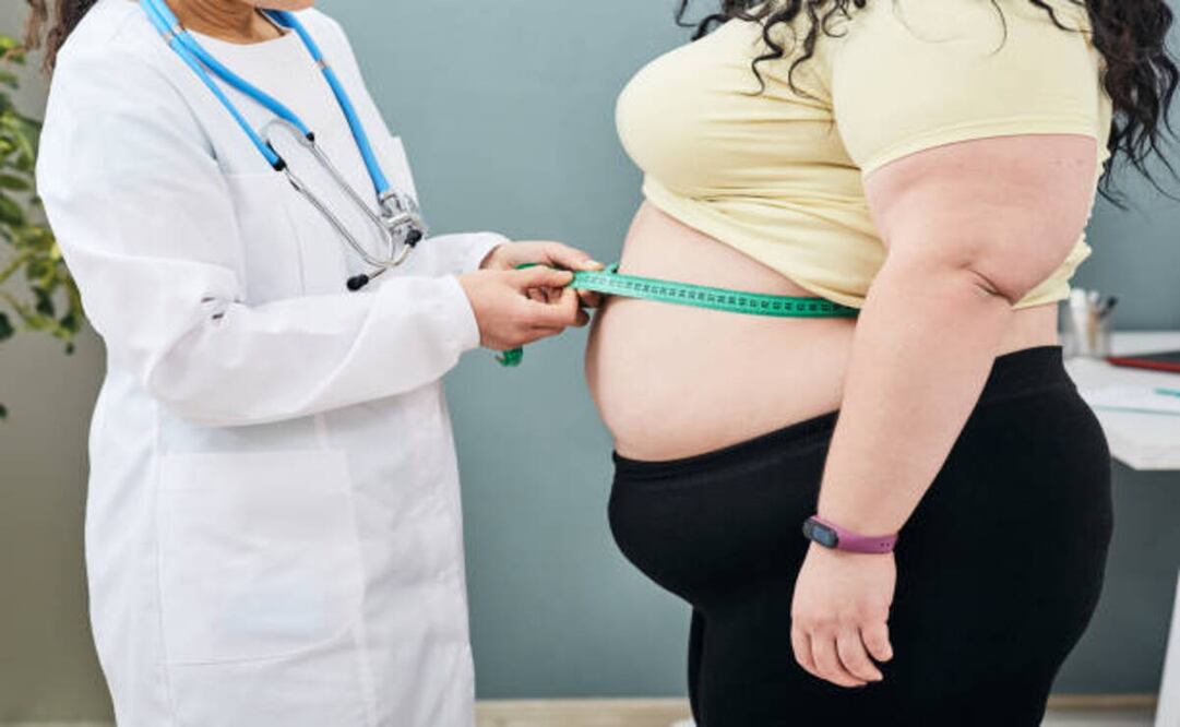 Cada 4 de marzo se celebra el Día Mundial de la Obesidad, una fecha que busca generar conciencia sobre esta enfermedad. Foto: istockphoto