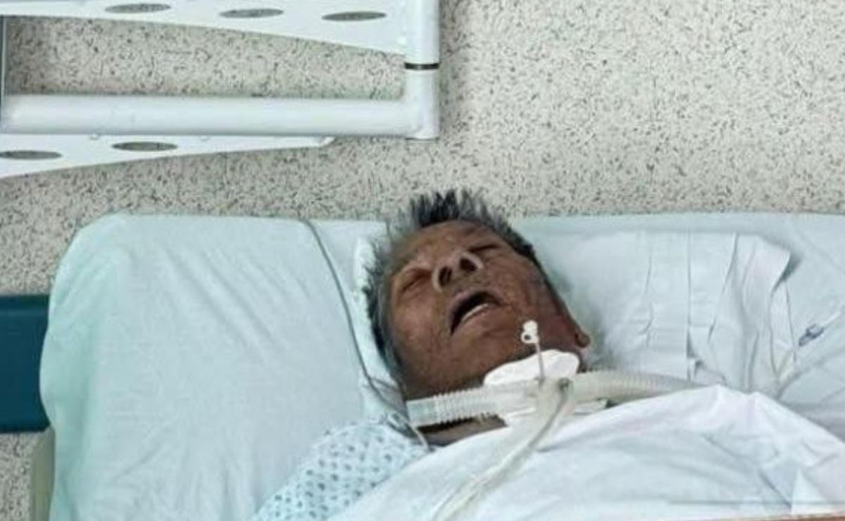 Andrés Filomeno Mendoza Celis, conocido como el "Monstruo de Atizapán", fue hospitalizado de emergencia en Toluca por graves problemas respiratorios y neumonía. Foto: Especial