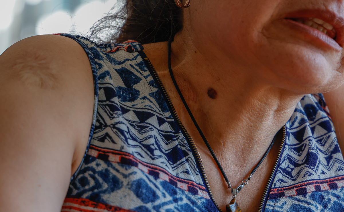 Su expareja la raptó de su trabajo en Temoaya, la golpeó, le infringió una herida en el cuello / Foto: Arturo Hernández
