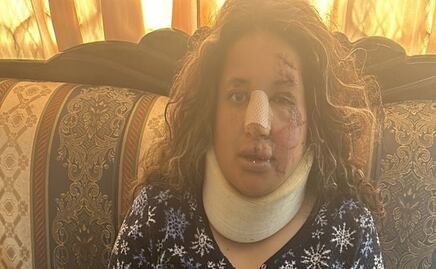 Profesora fue atropellada y la responsable evade la justicia