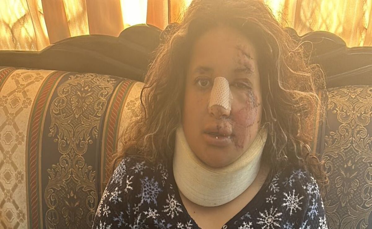 Profesora fue atropellada y la responsable evade la justicia