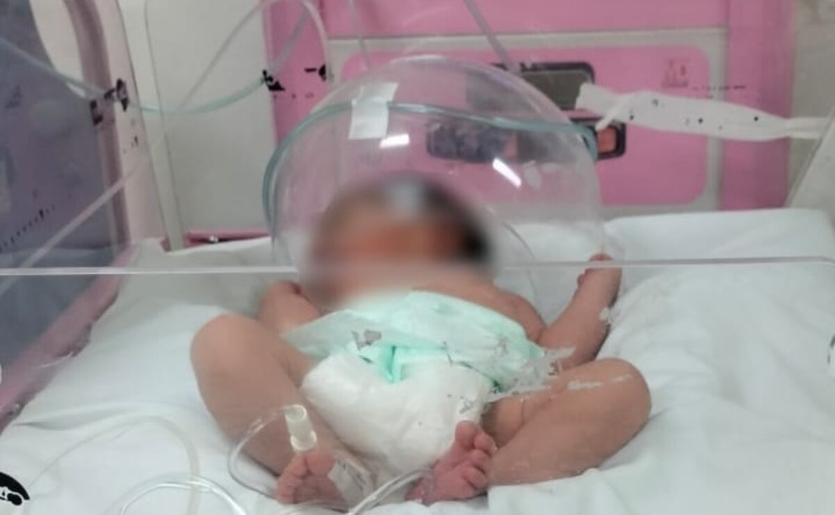 La bebé presentaba hipotermia / Foto Especial