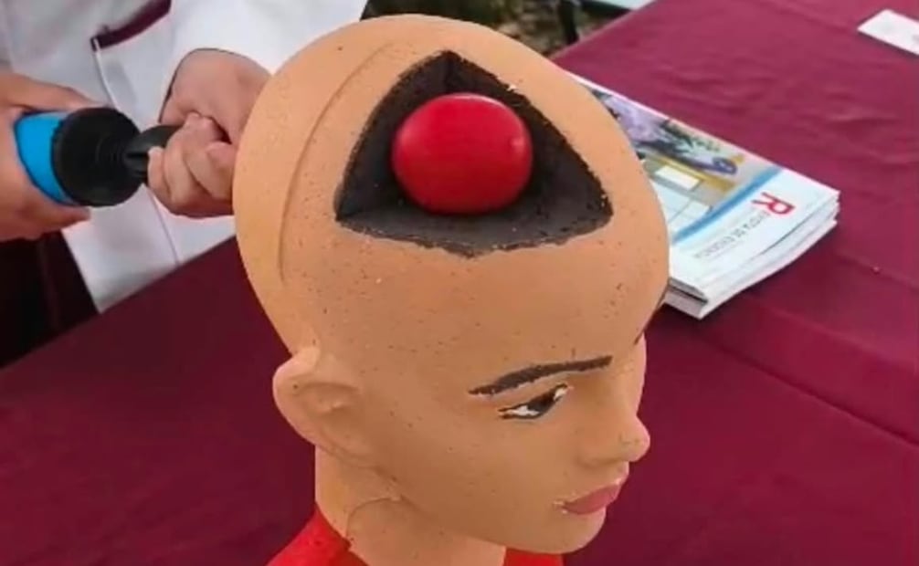 Médicos especialistas analizarán factores de riesgo de enfermedad vascular cerebral durante la jornada. foto especial
