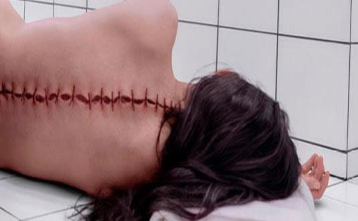 "La sustancia" (2024).