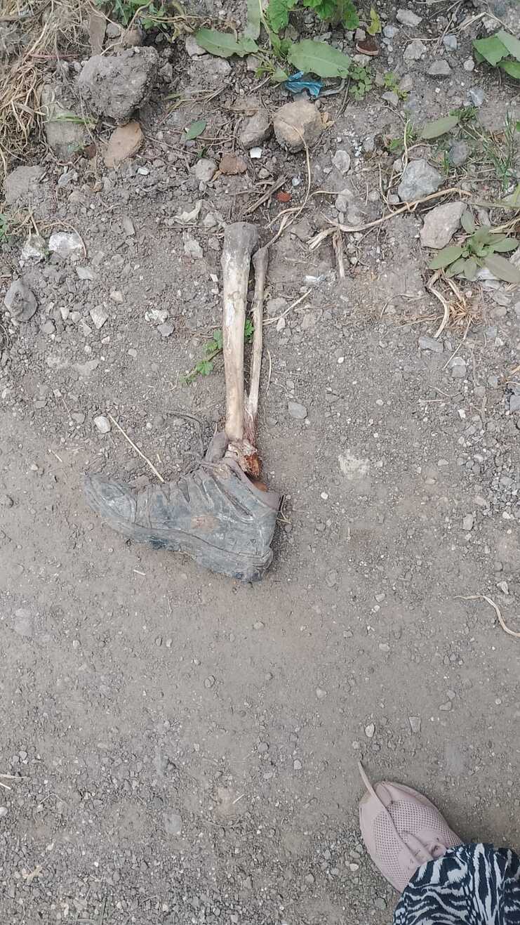 localizan pierna humana en cuautitlán izcalli