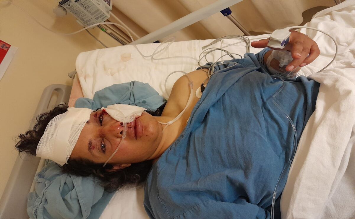 El impacto del atropello en la vida de María Patricia: de la educación física a la lucha por sus derechos / Foto: