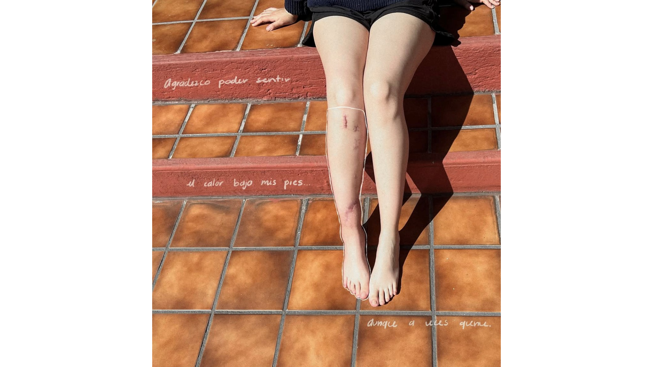 Tras el accidente, Brenda perdió a su mamá y sufrió fracturas múltiples en sus piernas. Foto: Especial