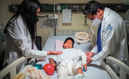 Edomex concentra el 8 por ciento de las quemaduras a nivel nacional