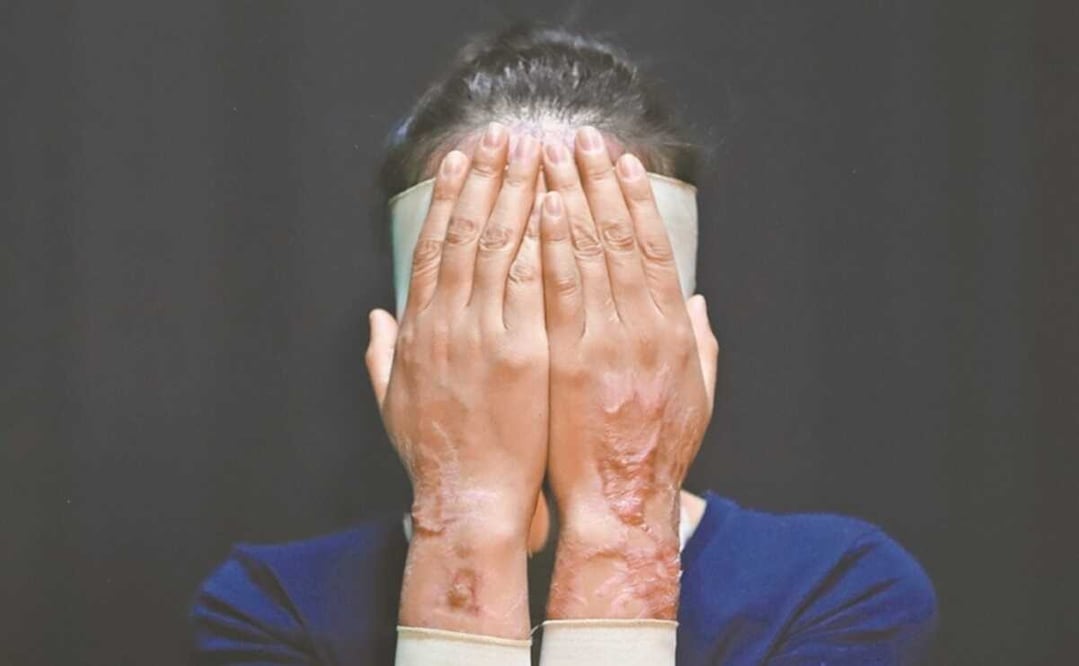 Buscan que el delito se clasifique como un tipo de violencia y no como lesiones/ Foto: Archivo EL UNIVERSAL