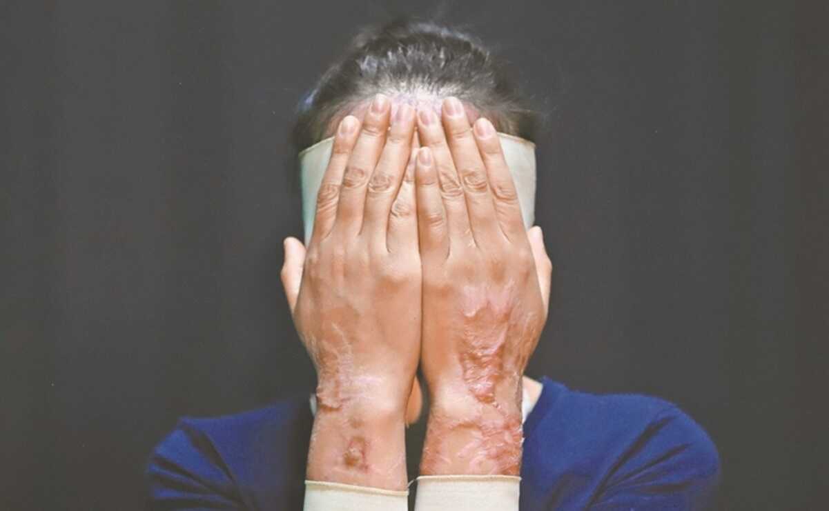 Buscan que el delito se clasifique como un tipo de violencia y no como lesiones/ Foto: Archivo EL UNIVERSAL