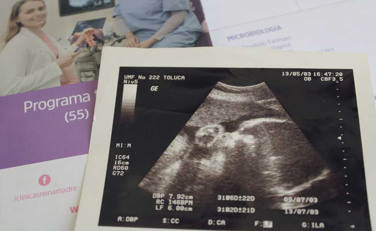 El costo de la inseminación artificial varía entre 20 mil y 40 mil pesos por ciclo en instituciones privadas. Foto: Especial