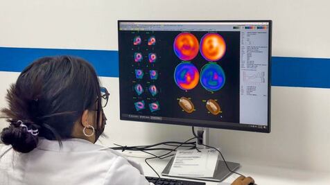 El IMSS incorpora tecnología SPECT en Tlalnepantla para diagnósticos cardíacos
