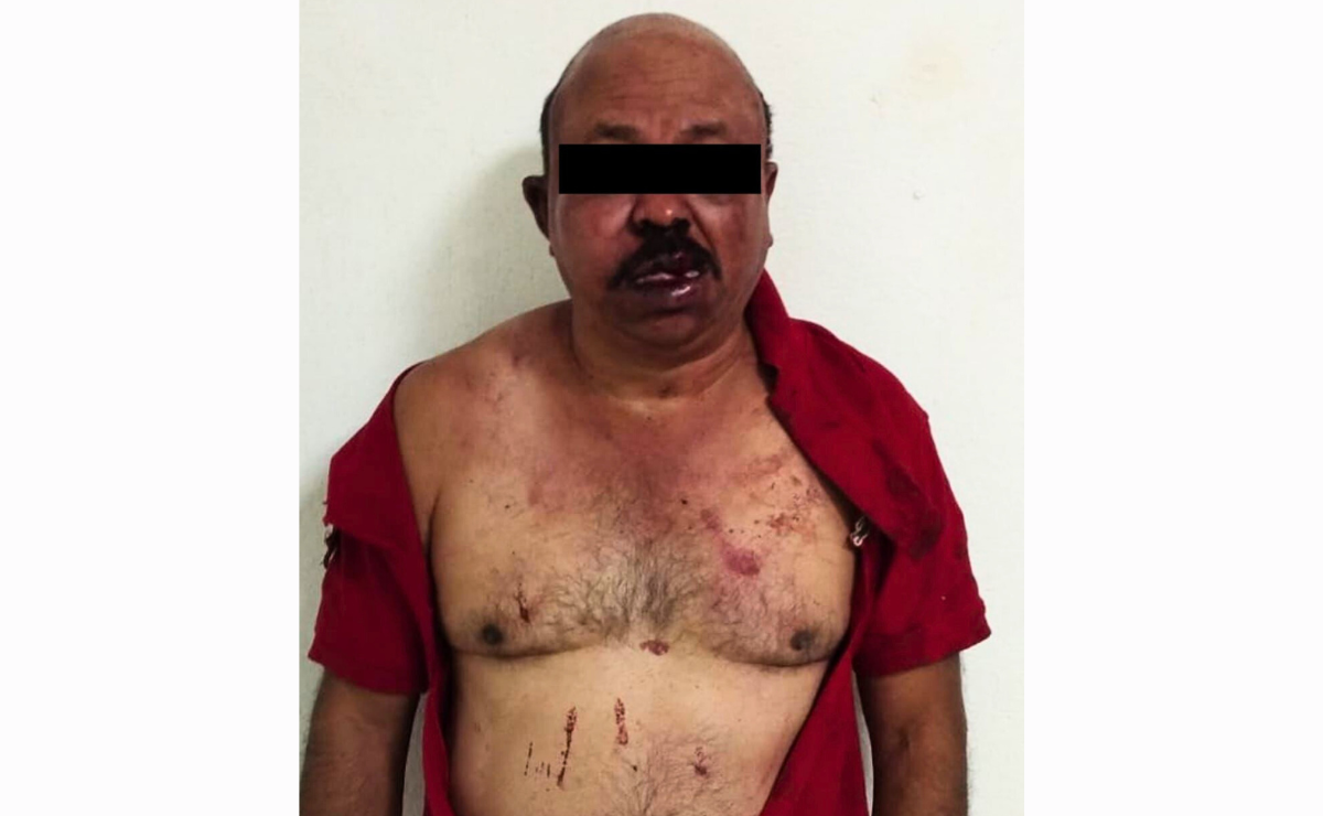 Conductor de aplicación detenido en Ecatepec tras ser agredido por vecinos al negarse a dejar descender a una pasajera. Foto: Especial