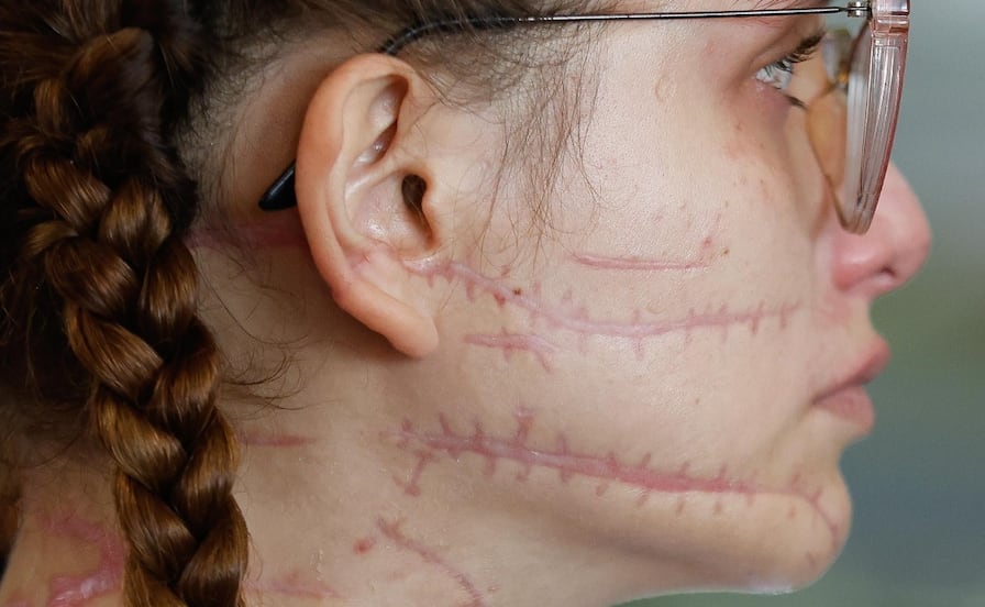 Joven apuñalada por su pareja denuncia amenazas para retirar cargos por intento de feminicidio