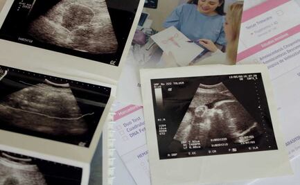 Inseminación artificial, la mejor opción para la infertilidad en Edomex  