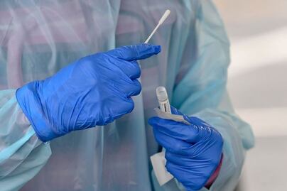 Ofrece UAEMéx pruebas de detección de Enfermedades de Transmisión Sexual