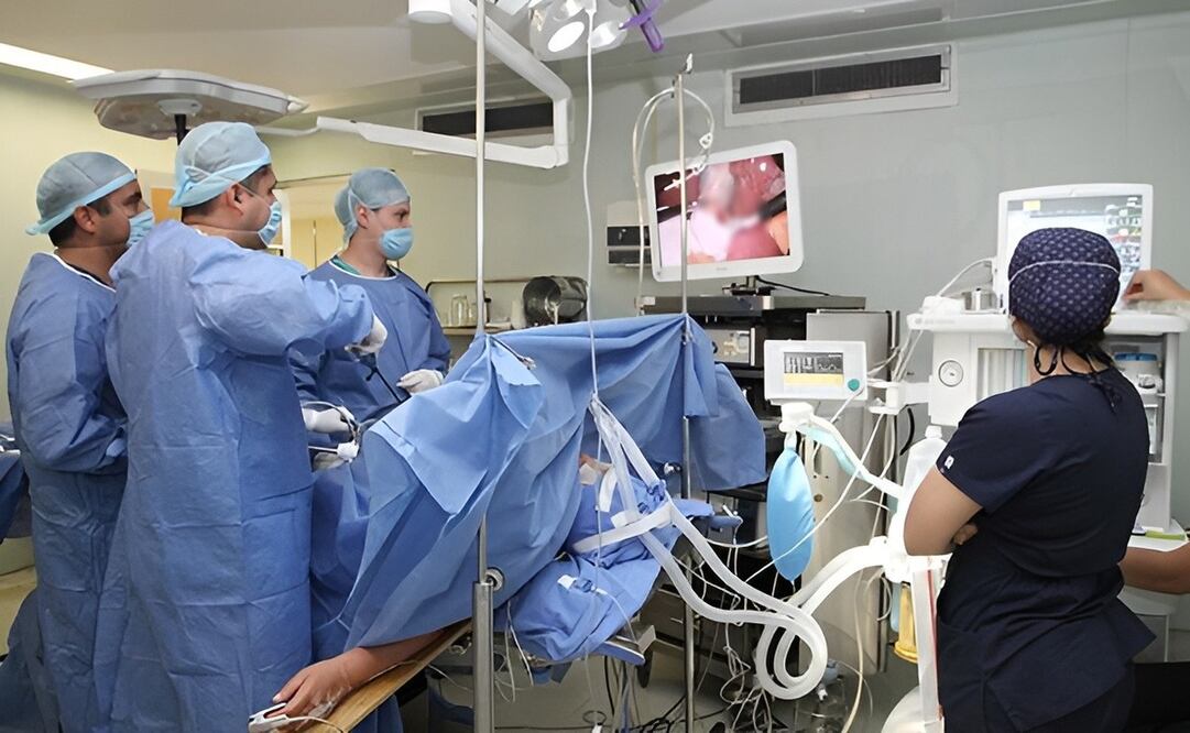 El ISEM pretende realizar hasta 3 mil cirugías laparoscópicas al cierre del año en el Estado de México. Foto: IMSS